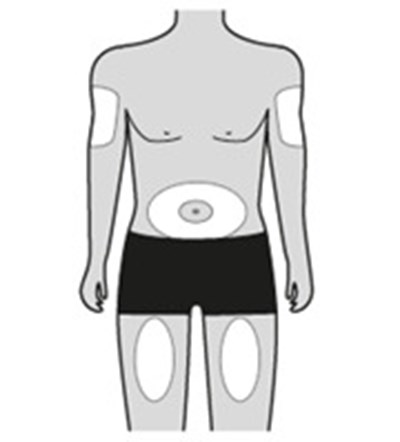 Figure 3 (Pic3   Henlius   Step For Ifu)
